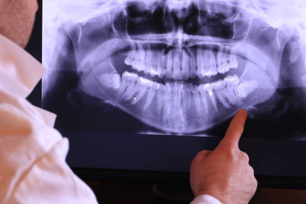 Best Emergency Tooth Extraction in Genoa, IL