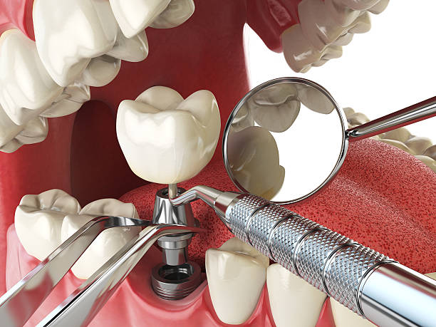 Best Emergency Dental Surgery in Genoa, IL